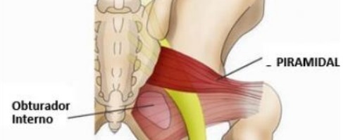 Dolor de cadera, síndrome pirmidal