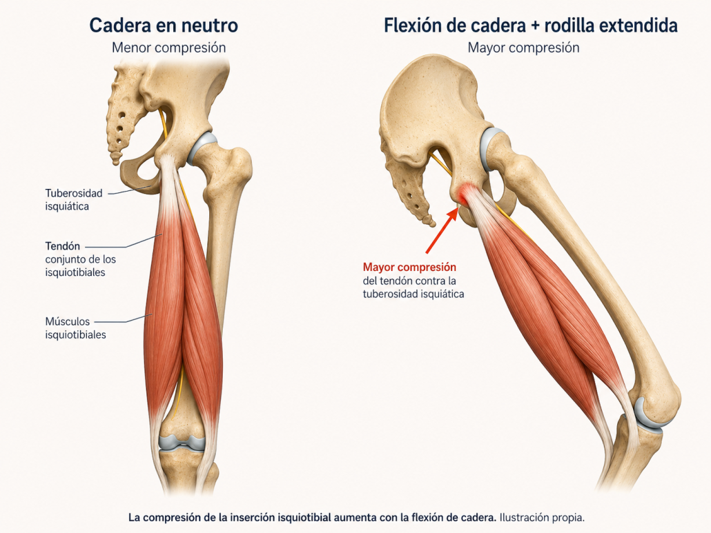 Flexión de cadera y compresión tendón proximal isquiotibiales Flexión de cadera y compresión tendón proximal isquiotibiales